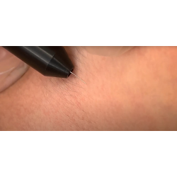 Epilations Needle isoliert