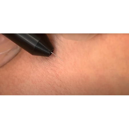 Elettrodo puntiforme in argentone per epilazione
