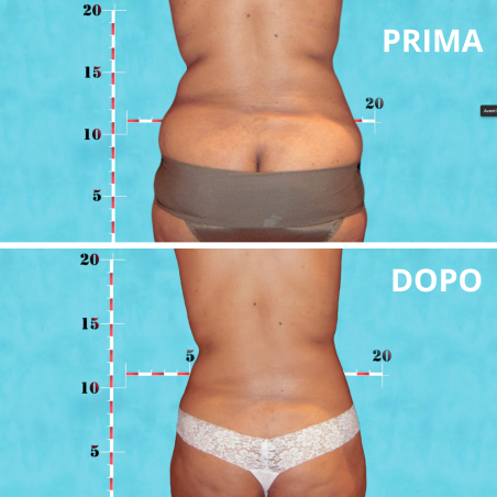 MC1 - Ultrasound system