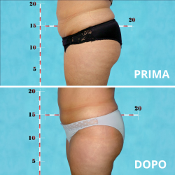 MC1 - Ultrasound system