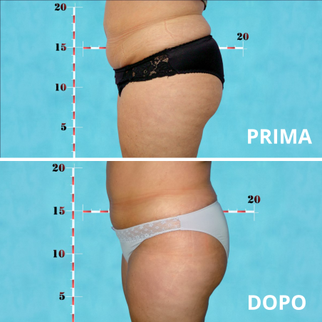 MC1 - Ultrasound system