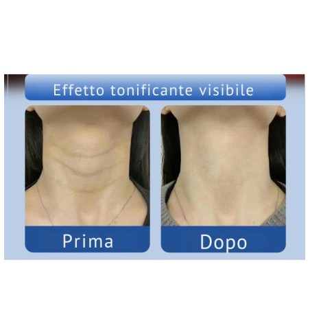 EMS LED Therapy Neck Beauty Device | Massaggio Collo e Viso