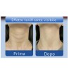 EMS LED Therapy Neck Beauty Device | Neck & Face Massage