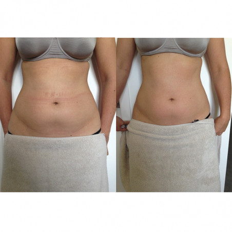 Semi-usato Cellutec G5 deLuxe Body